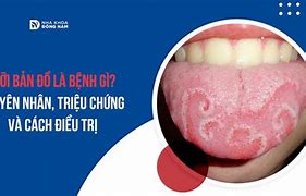 Bệnh Hemo Là Bệnh Gì